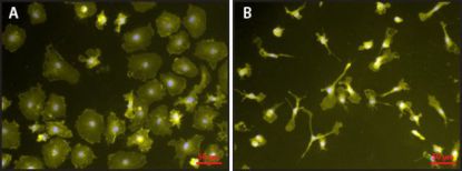 图片 脂多糖来源于大肠杆菌0111:B4；Lipopolysaccharides from Escherichia coli O111:B4 [LPS]；purified by phenol extraction