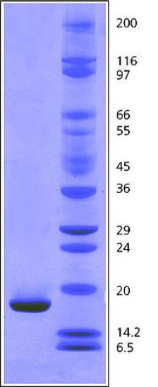 图片 肌红蛋白来源于马骨骼肌，Myoglobin from equine skeletal muscle；BioUltra, ≥98% (SDS-PAGE)