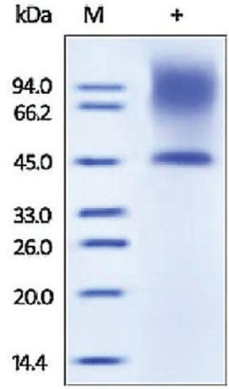 图片 人核心蛋白聚糖 [骨蛋白聚糖II]，Decorin/Bone proteoglycan II human [DCN]；recombinant, expressed in HEK 293 cells, ≥95% (SDS-PAGE)