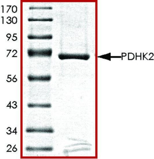 图片 PDHK2, active, GST tagged human [PDK2]；PRECISIO® Kinase, recombinant, expressed in baculovirus infected Sf9 cells, ≥70% (SDS-PAGE), buffered aqueous glycerol solution