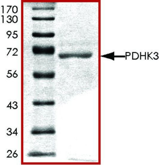 图片 PDHK3, active, GST tagged human [PDK3]；PRECISIO® Kinase, recombinant, expressed in baculovirus infected Sf9 cells, ≥70% (SDS-PAGE), buffered aqueous glycerol solution