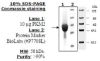 图片 丙酮酸激酶M2，Pyruvate kinase M2 Active from mouse [PKM2, PK3, M2-PK tumor]；recombinant, expressed in E. coli, ≥90% (SDS-PAGE)