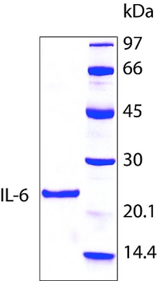 图片 人白介素-6，Interleukin-6 human [IL6]；hIL-6, recombinant, expressed in E. coli, lyophilized powder, suitable for cell culture, ≥97% (SDS-PAGE)