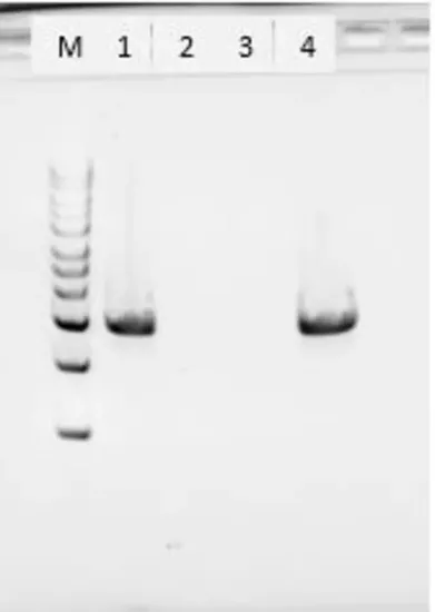 图片 蛋白酶K来源于林伯氏白色念球菌，Proteinase K from Tritirachium album；free of DNA contaminants, suitable for Microbiome research, lyophilized powder, ≥30 units/mg protein