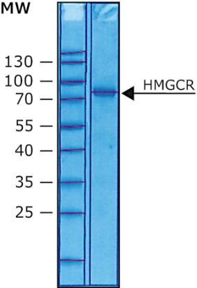 图片 3-羟基-3-甲基戊二酰-CoA还原酶来源于人，3-Hydroxy-3-methylglutaryl-CoA reductase human [HMGCoA Reductase, HMGR]；≥90% (SDS-PAGE), solution