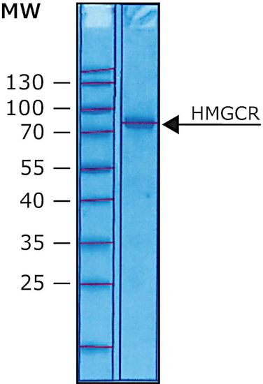 图片 3-羟基-3-甲基戊二酰-CoA还原酶来源于人，3-Hydroxy-3-methylglutaryl-CoA reductase human [HMGCoA Reductase, HMGR]；≥90% (SDS-PAGE), solution
